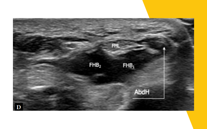 4. Musculatura intrinseca pie ecografia tempo formacion.png